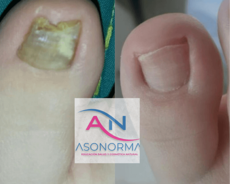 Consulta Podológico