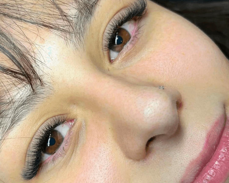 Capping (retención +40 días)