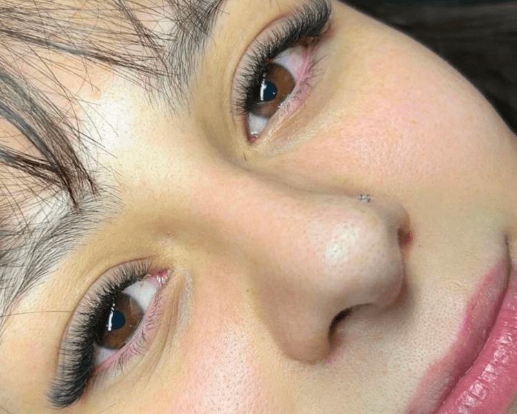 Capping (retención +40 días)