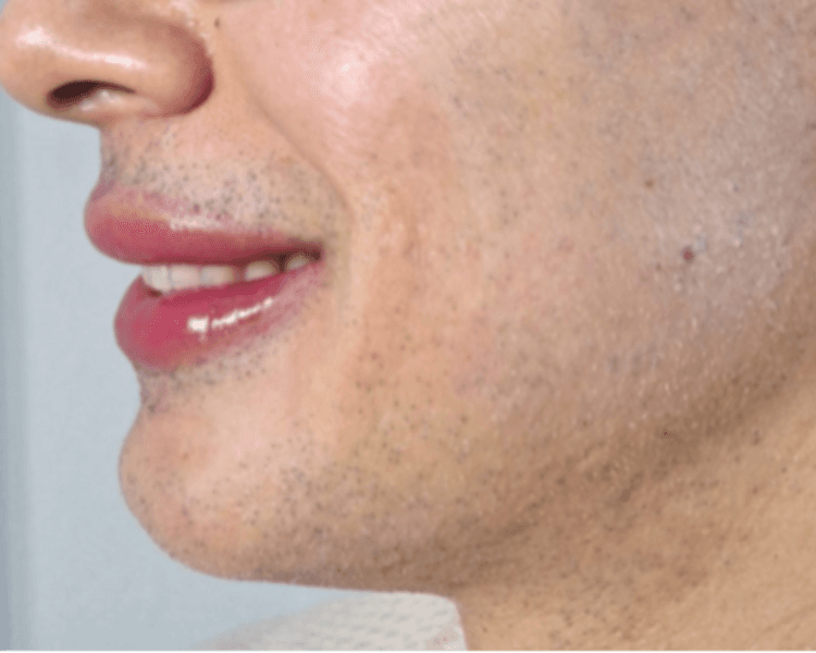 Reserva Hora Micropigmentación Labios