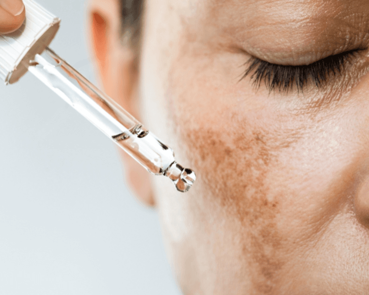 Facial Con Micropunción + EXOSOMAS WHITENING