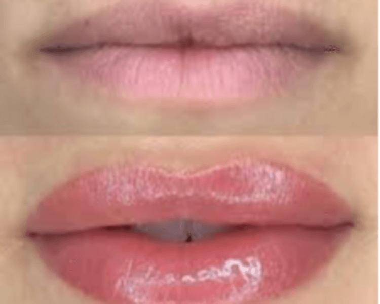 💋 Hidralips: Labios esplendidos e hidratados