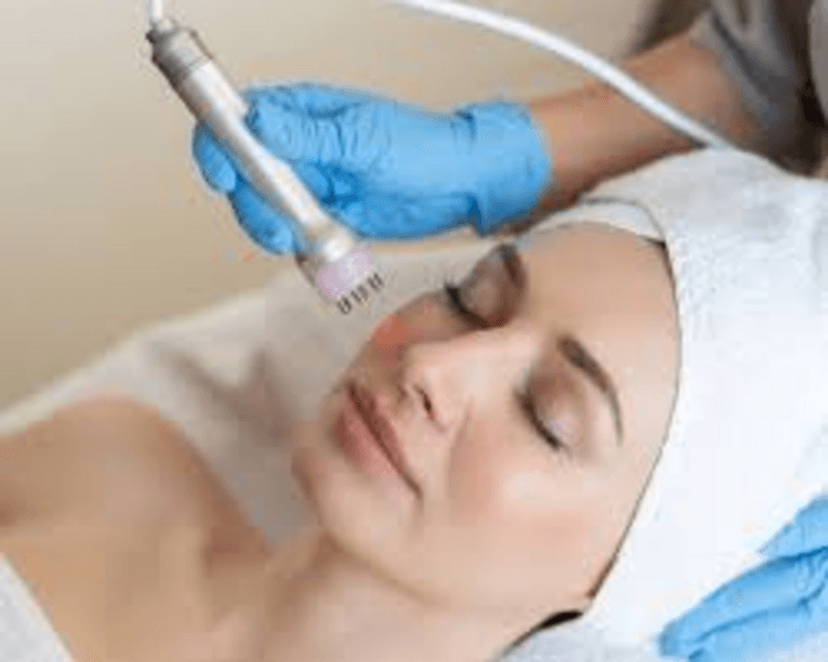 ✨ RADIOLIFTING EXPRES — Efecto firmeza al instante