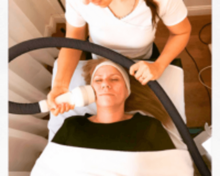 Sesión de tensado facial con Crioradiofrecuencia