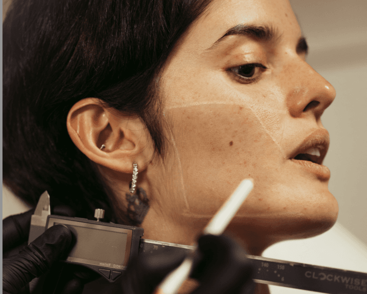 Armonización Facial - BioStructure™