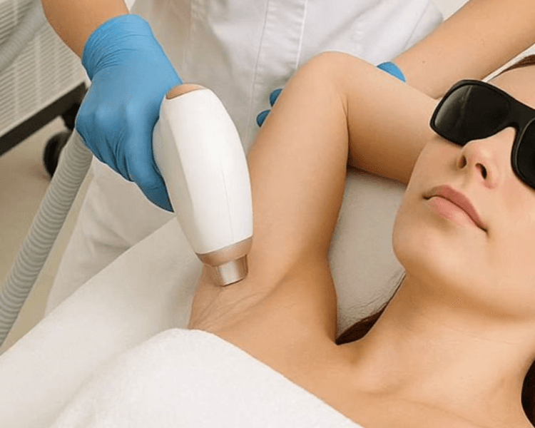 Depi Axilas - PRIMELASE