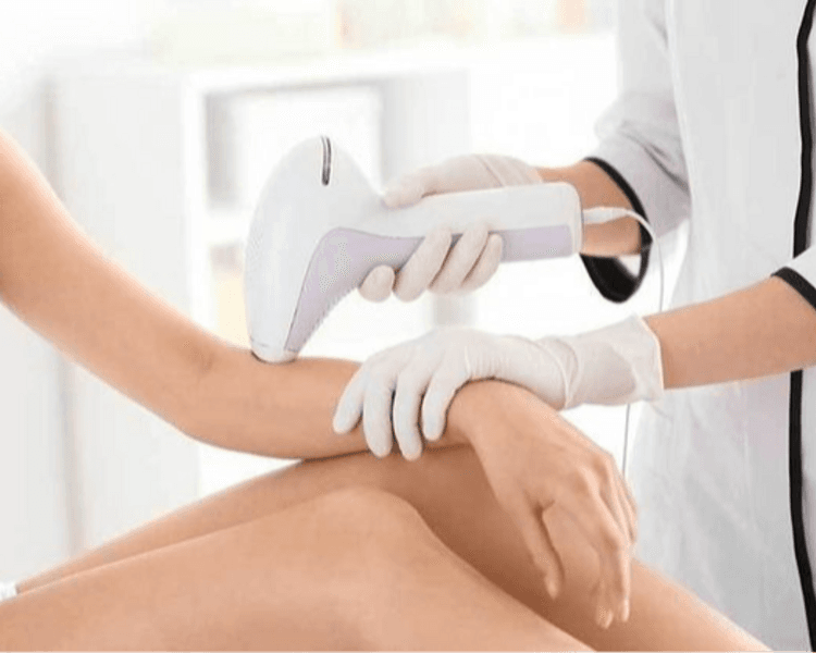 Depi brazos - PRIMELASE