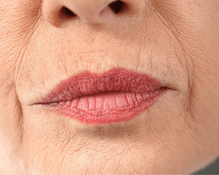 Botox - Código de Barras