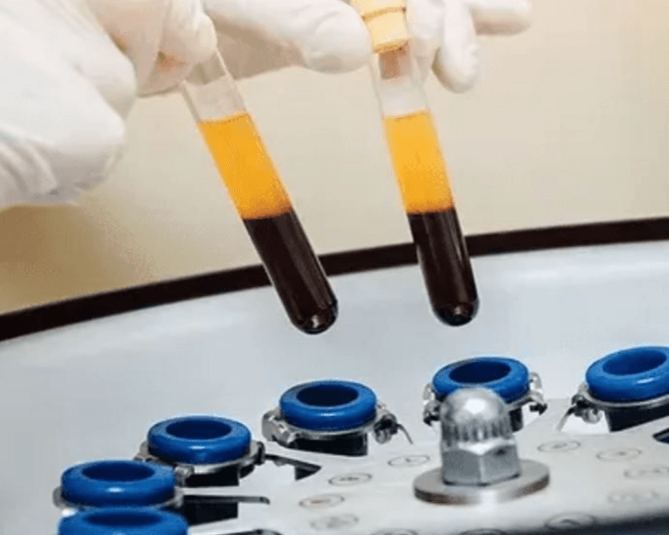 Plasma Rico en Plaquetas facial 1ss