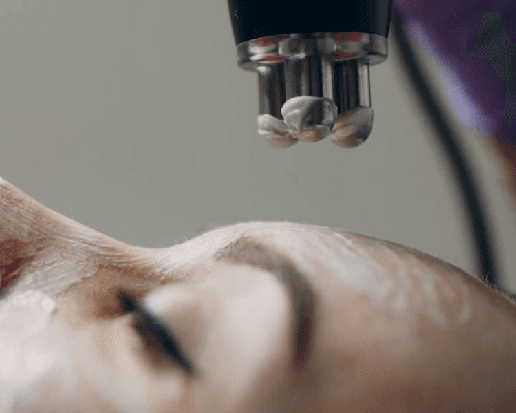 Higiene Facial Profunda + Radiofrecuencia