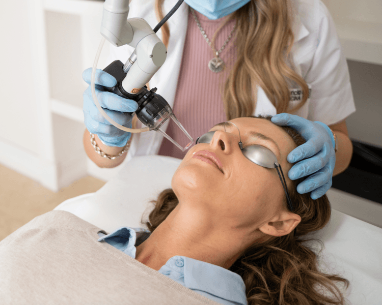 Resurfacing facial FULL FACE intenso (con párpados)