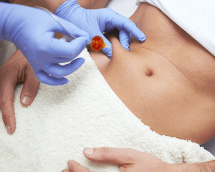 Carboxiterapia Corporal x1