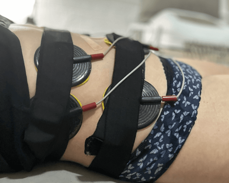 1 sesión FIRM&LIFT (reafirmar + tonificar): Radiofrecuencia + Electrodos en 1 zona