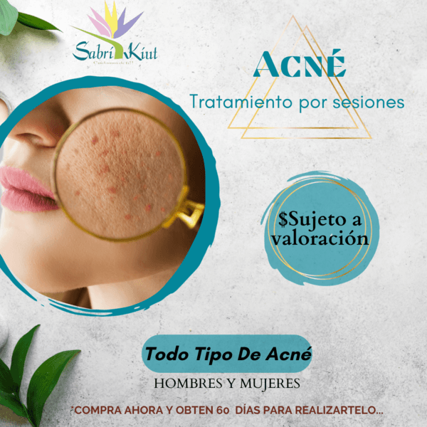 ACNÉ (TRATAMIENTO POR SESIONES)