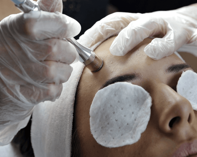 Facial anti acné