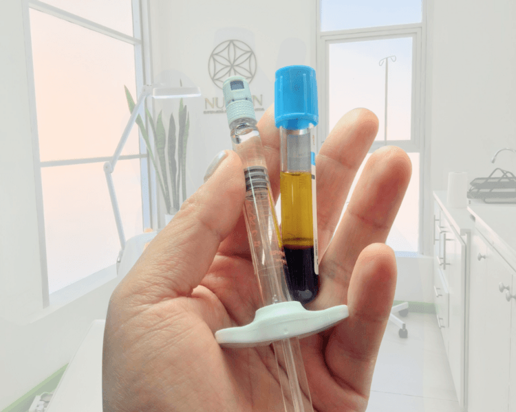 Plasma Capilar + PDNR (semen de salmón) (4 sesiones)