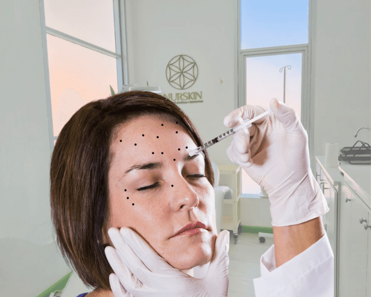 Toxina Botulínica Full Face (100UI)