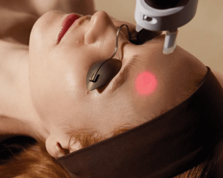 Eliminación de Manchas (1 sesión)