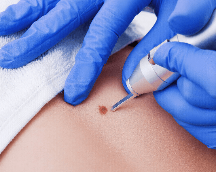 Consulta Dermatología 👨⚕️