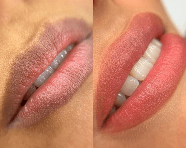 Neutralización - Para labios oscuros o con manchas
