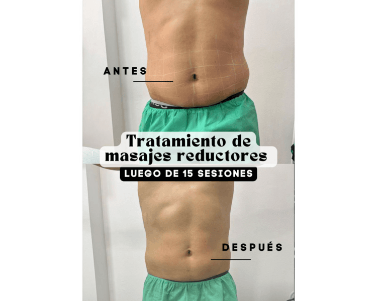 Tratamiento Corporal 15 sesiones