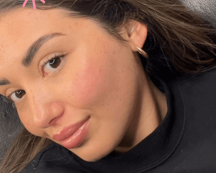 Lifting+Perfilado+Laminado