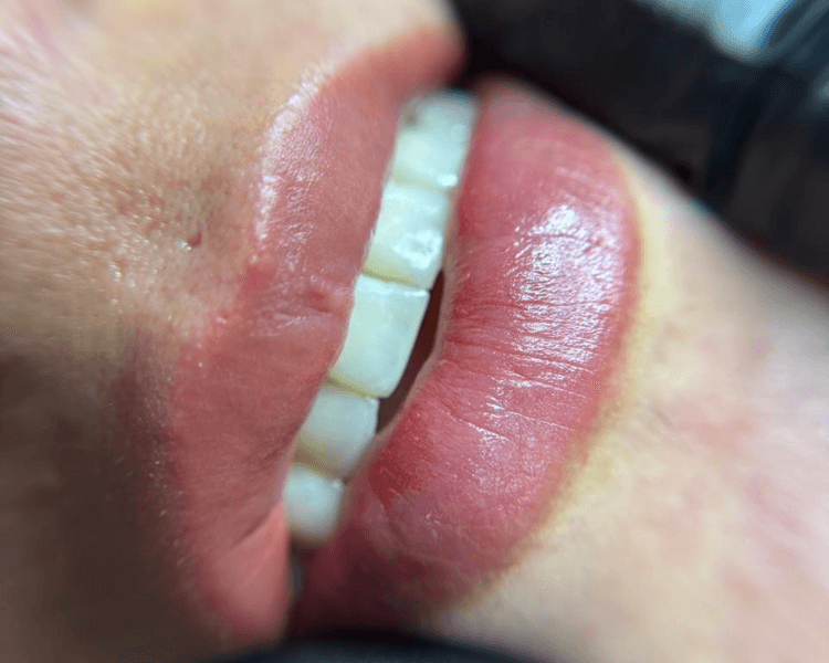 Soft Lips (Micropigmentación de labios)