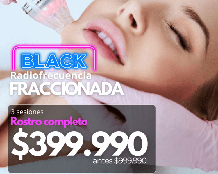 3 SESIONES RADIOFRECUENCIA FRACCIONADA ROSTRO COMPLETO