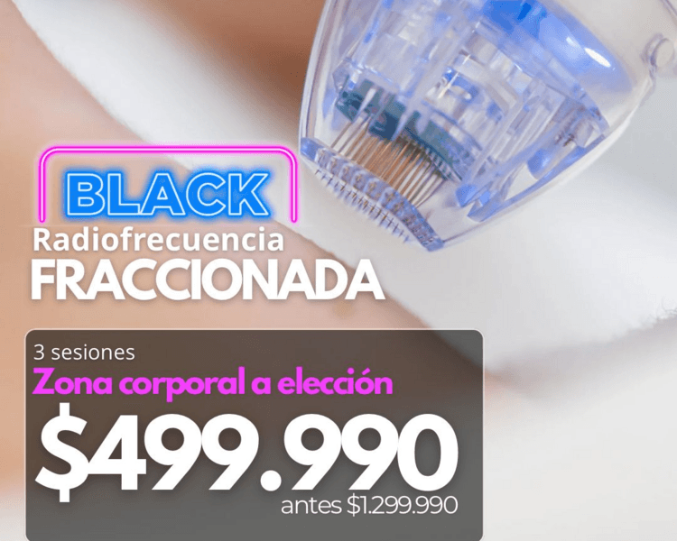 3 SESIONES RADIOFRECUENCIA FRACCIONADA 1 ZONA CORPORAL