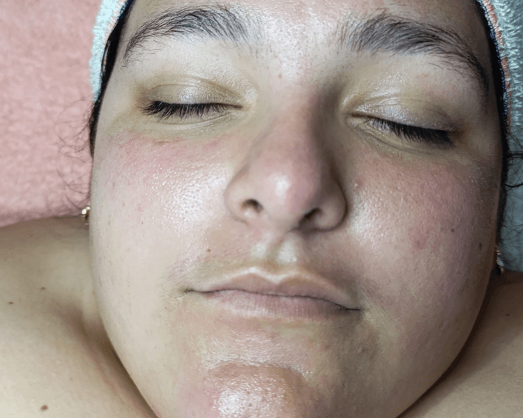 Diagnóstico Facial