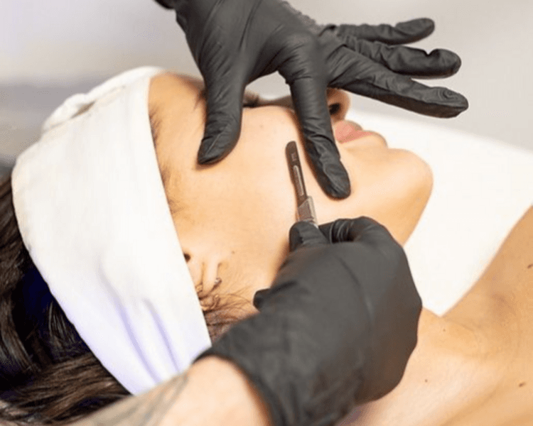 Limpieza Facial + Dermaplanning