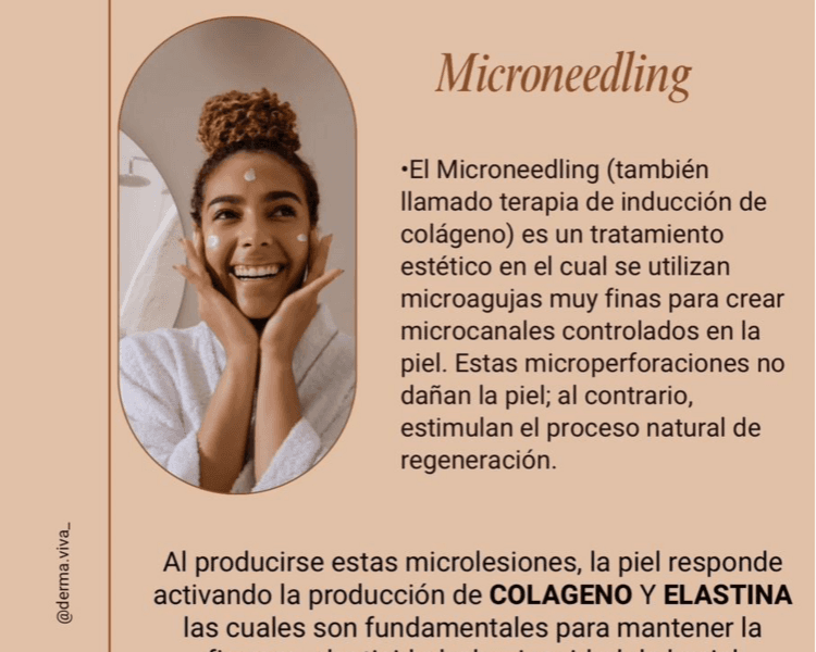 Microneedling