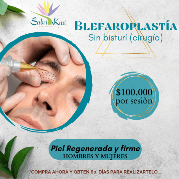 BLEFAROPLASTÍA SIN BISTURÍ (CIRUGÍA)