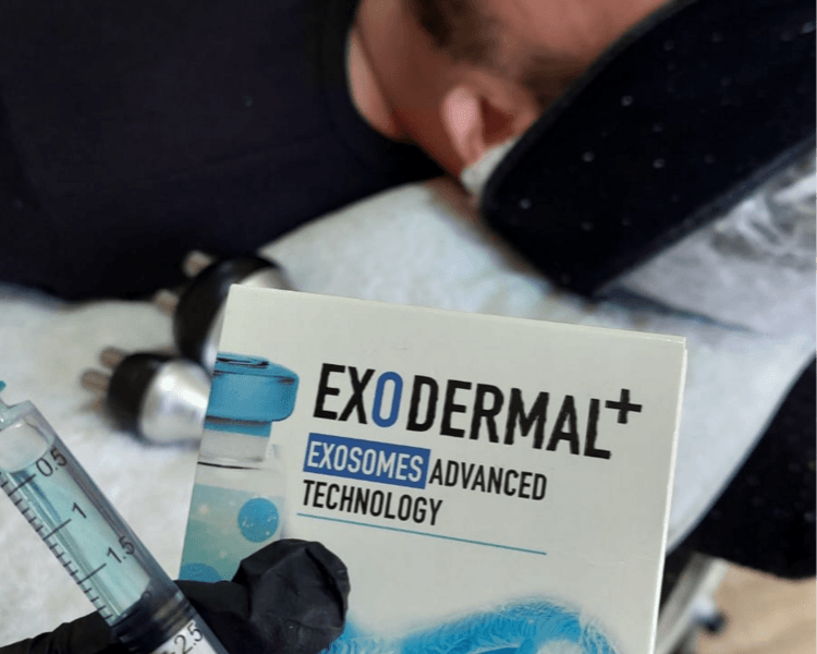 BB GLOW – 70 minutos