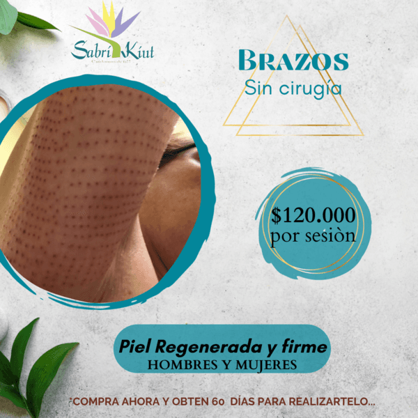 BRAZOS SIN CIRUGÍA