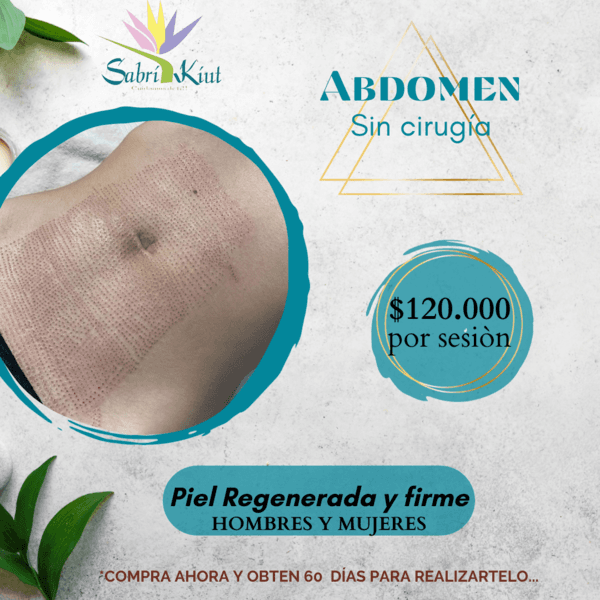 ABDOMEN SIN CIRUGÍA