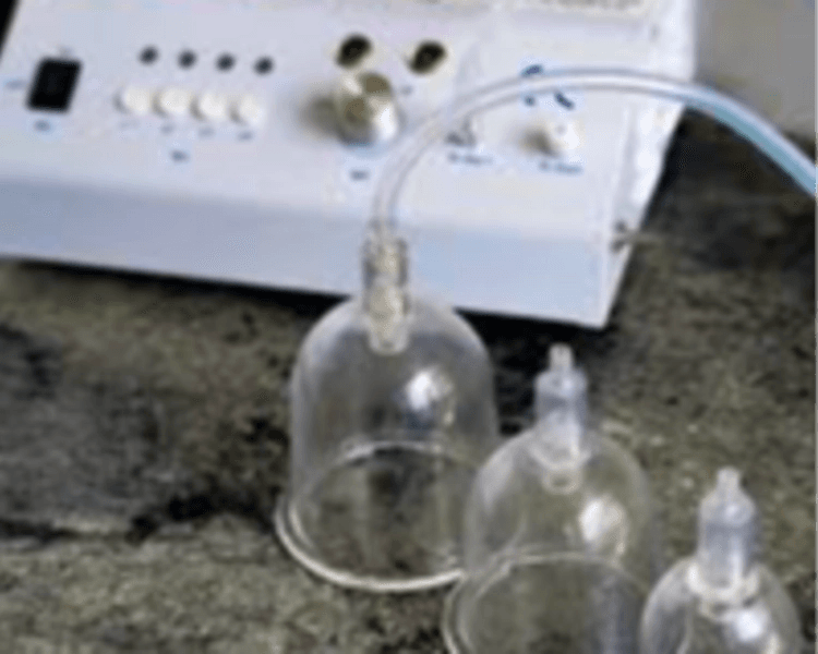 Ventosas Tratamiento de Ozono