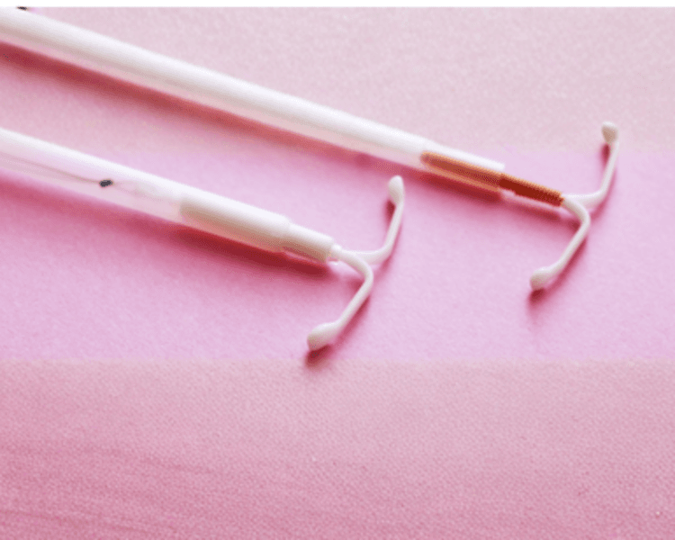 🌸 Recambio Implante / DIU (No incluye Implante/DIU)