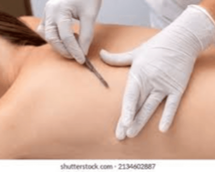 DERMAPLANING CORPORAL x 1 zona