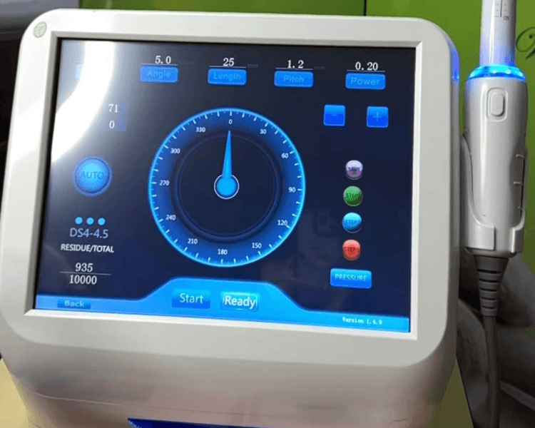 Plan 3 sesiones de Hifu Vaginal promo