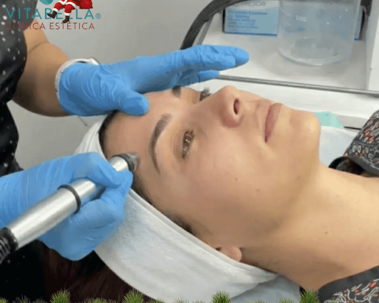 Limpieza Facial Profunda con Hydrapeeling Aquabella