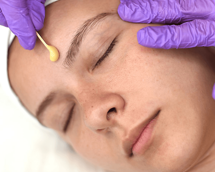 Depilación de Rostro