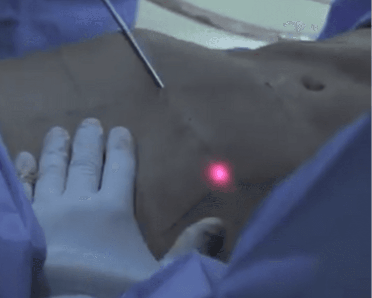 πΌπ΄π»π° π°ππππππ (π»πππππππππππππ ππ πππππππ ππΈπ½ πππππππ)