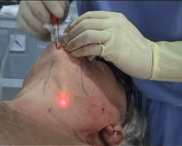 πΌπ΄π»π° πΏπππππ (π»ππππππππππππ)