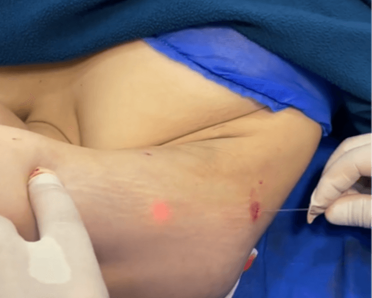 πΌπ΄π»π° π±πππ£ππ (π»πππππππππππππ πππππ ππ ππππ£ππ)