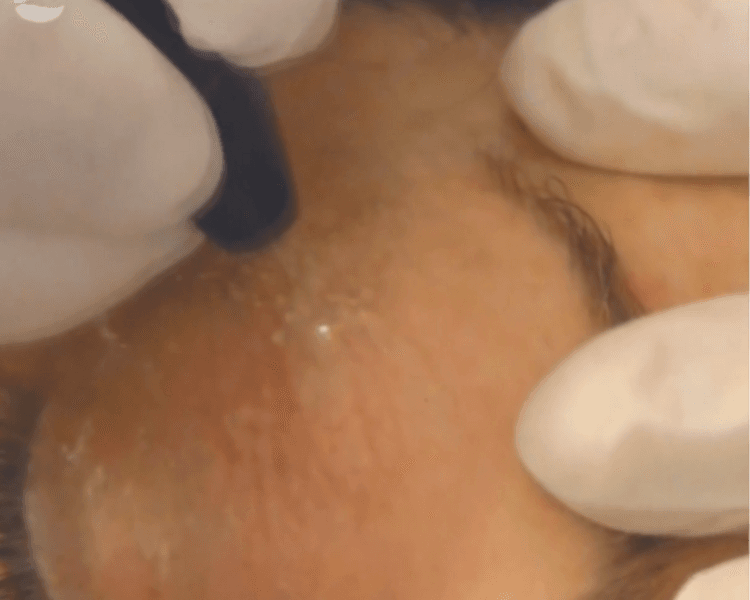 π±πππππππππππππ π½πΎ ππππππππππ