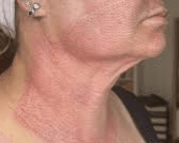 π²πππππ πππ π΅πππππππππ