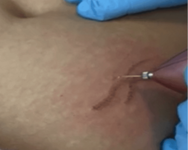 πππππππππππ ππ π΄ππππππ