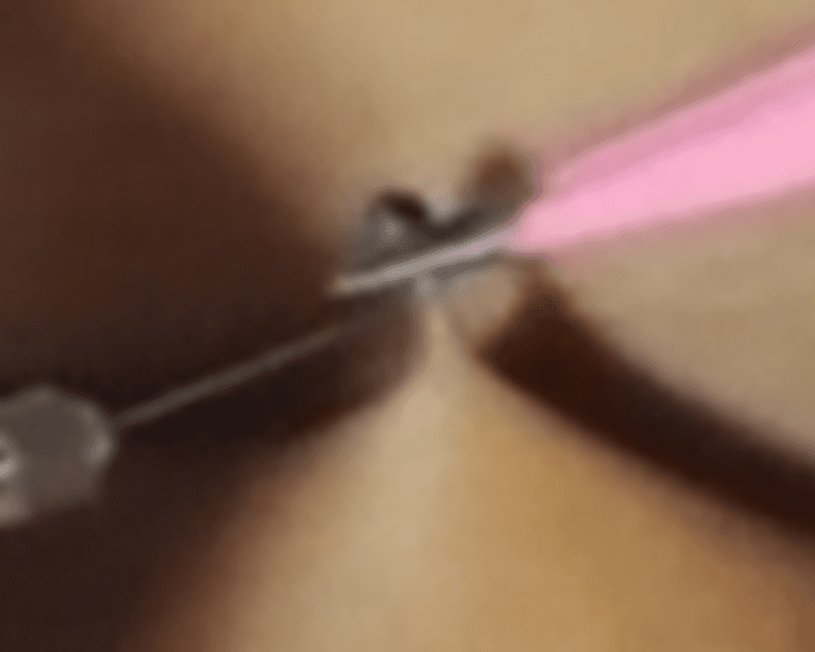 π΄ππππππππππ ππ ππππππππ/πππππππππ