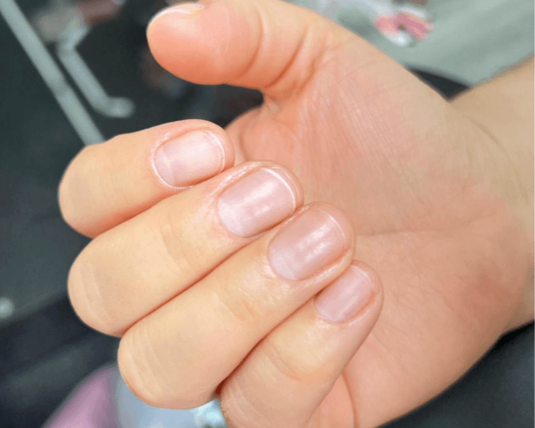 Retiro definitivo + limpieza de cutícula